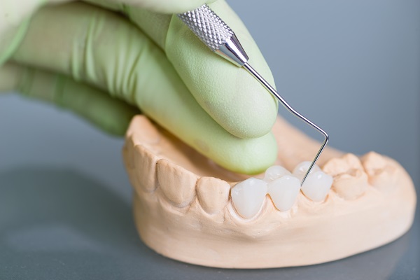 How To Choose The Right Type Of Dental Crown Material