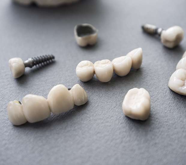 West Palm Beach The Difference Between Dental Implants and Mini Dental Implants